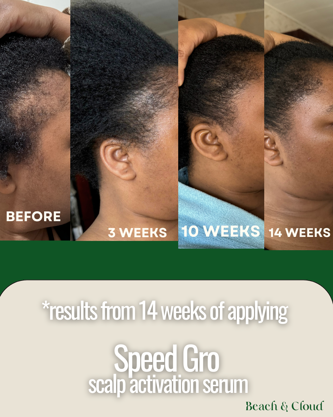 SPEED GRO SCALP ACTIVATION SERUM